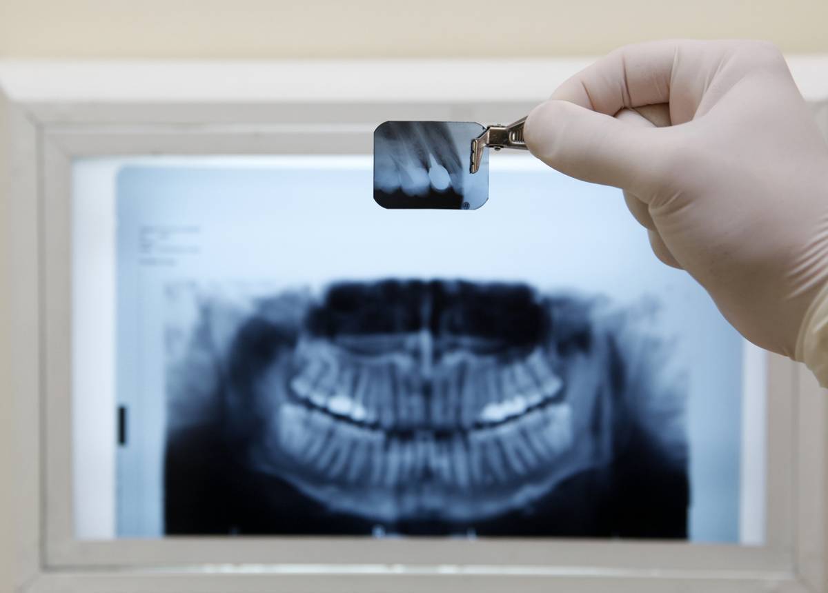 À quoi sert l'imagerie 3D dans le milieu dentaire ?