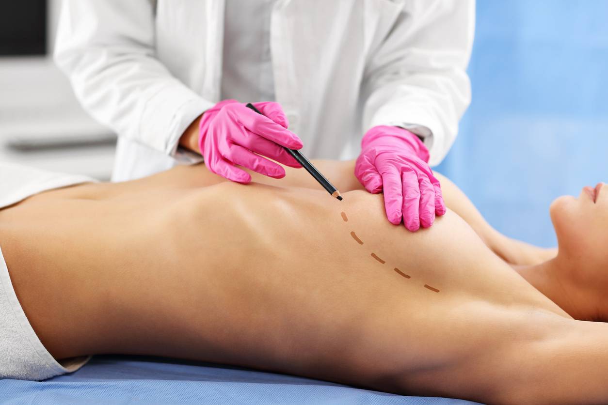 chirurgie esthétique des seins